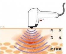 面部提升熱拉提廠家報價熱拉提價格