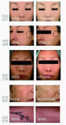 超皮秒公司_超皮秒儀器供應(yīng)商_超皮秒是亞皮秒嗎？
